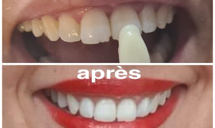 Bella Nails : Manucure à Sérignan-du-Comtat