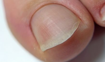 L'ongle des sens : Manucure à Aubière