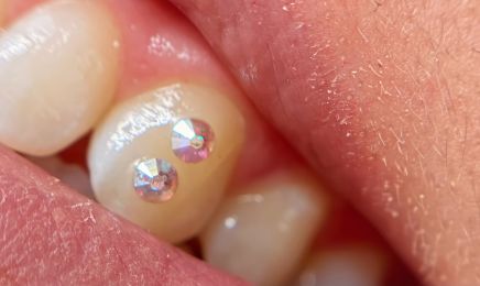 IrviNails : Manucure à Saint-Malo