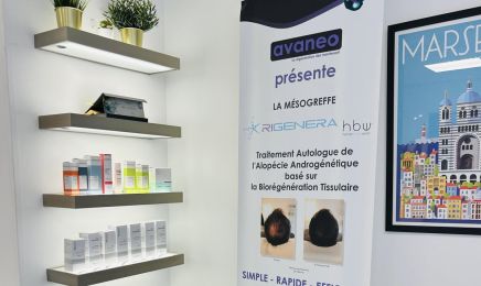 CAP'CLINIC® Médecine Esthétique - Centre Laser - Greffes Capillaires Fue : Institut de beauté à Marseille