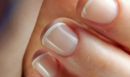 NAILS THERAPY : Manucure à Chambourcy