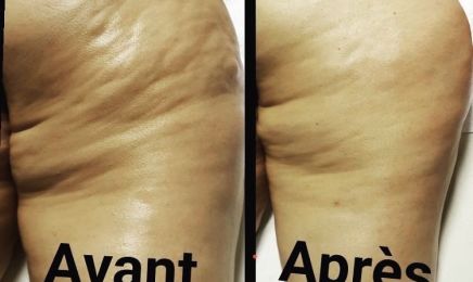 Sculpt Body Tech : Institut de beauté à Margny-lès-Compiègne