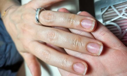 Ongles Enfolie : Manucure à Rieux