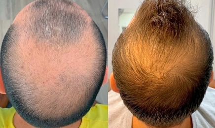 Cabinet Dermo Esthétique : Coiffeur à Rocbaron