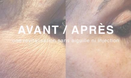 Swiss esthetic 83 : Institut de beauté à La Seyne-sur-Mer