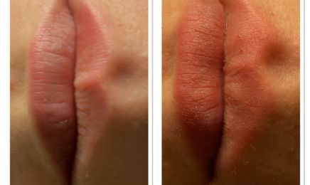 Sculpt Body Tech : Institut de beauté à Margny-lès-Compiègne