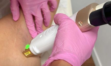 Laser Skin Confidence : Institut de beauté à Puget-sur-Argens