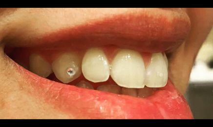 Diamond'lyne : Manucure à Dax