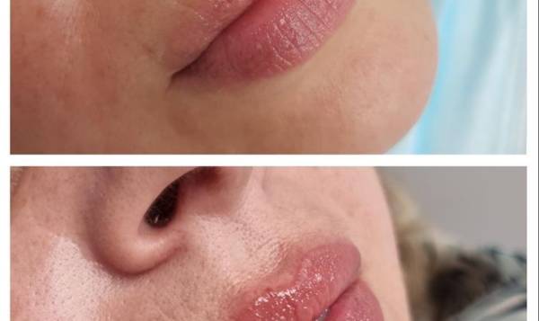 Dermobeauty esthetique 