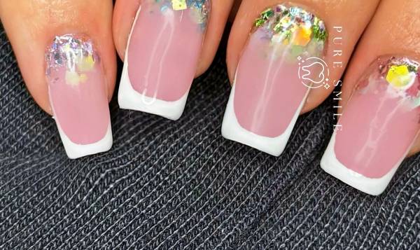 Promesse Clinic - épilation laser définitive - fil de collagène - lifting coréen