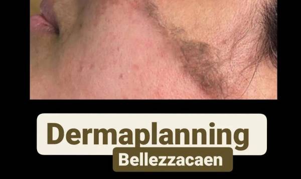 Bellezza Caen