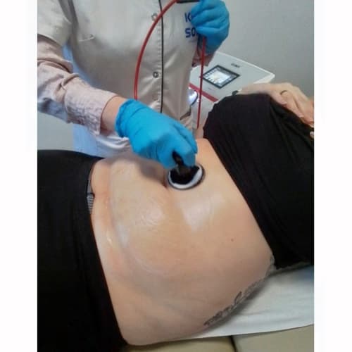 Kryo Soins - Institut de beauté Thionville - Kryo Soins - Photo Galerie - OneBooking