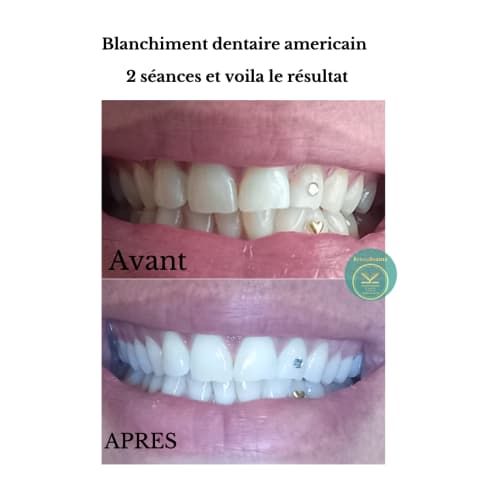 Kenze Naturel Piercing et Beauté - Onglerie Tours - Kenze Naturel Piercing et Beauté - Photo Galerie - OneBooking