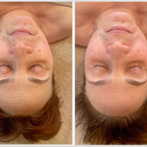 CLAIRE WIART FACIALISTE - Institut de beauté Arras - CLAIRE WIART FACIALISTE - Photo Galerie - OneBooking