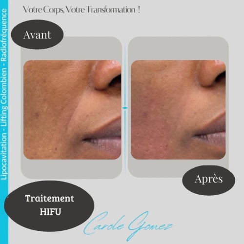 Carole Lipocavitation - Sourcils & cils Bourges - Carole Lipocavitation - Photo Galerie - OneBooking