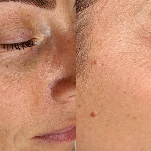 PURE Aesthetics - Institut de beauté Montpellier - PURE Aesthetics - Photo Galerie - OneBooking