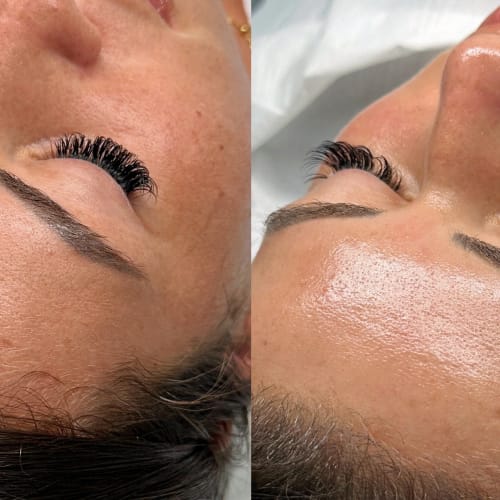 PURE Aesthetics - Institut de beauté Montpellier - PURE Aesthetics - Photo Galerie - OneBooking