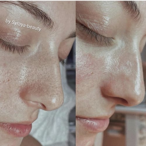 Syraya Beauty - Institut de beauté Grenoble - Syraya Beauty - Photo Galerie - OneBooking