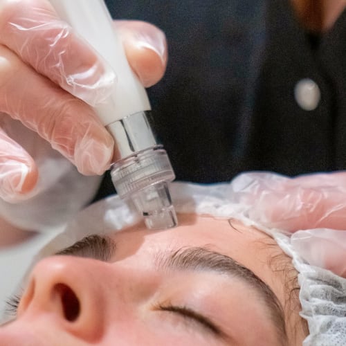 Charlène Esthétique Cosmétique - Épilations, Ongles, Soins, Hydraskin & Madérothérapie - Soin visage Nice - Charlène Esthétique Cosmétique - Épilations, Ongles, Soins, Hydraskin & Madérothérapie - Photo Galerie - OneBooking