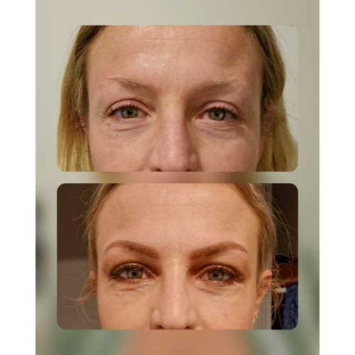 Studio Beauty & Brow - Épilation Laser - Institut de beauté Montpellier - Studio Beauty & Brow - Épilation Laser - Photo Galerie - OneBooking