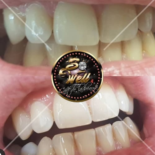 So Well - Onglerie Clermont-Ferrand - So Well - Photo Galerie - OneBooking