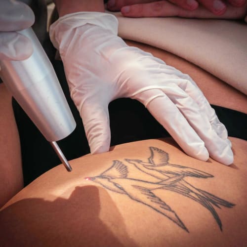 Centre Laser du Rempart - Epilation définitive - Thermolyse - Soins esthétiques laser - Sourcils & cils Colmar - Centre Laser du Rempart - Epilation définitive - Thermolyse - Soins esthétiques laser - Photo Galerie - OneBooking
