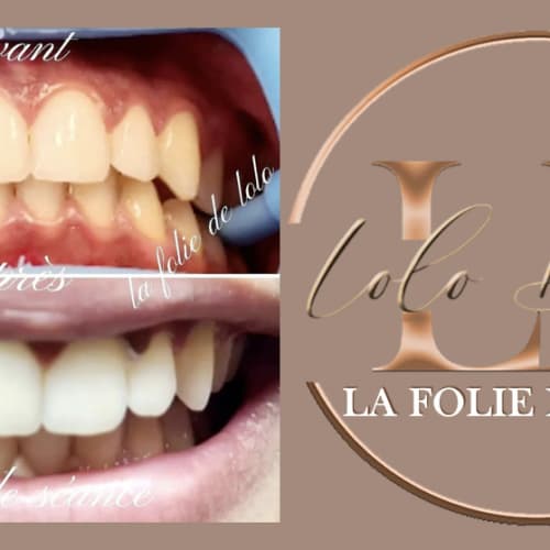 La Folie de Lolo - Sourcils & cils Nice - La Folie de Lolo - Photo Galerie - OneBooking