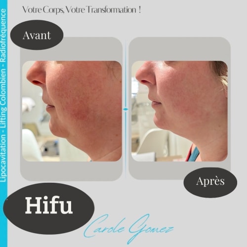 Carole Lipocavitation - Sourcils & cils Bourges - Carole Lipocavitation - Photo Galerie - OneBooking
