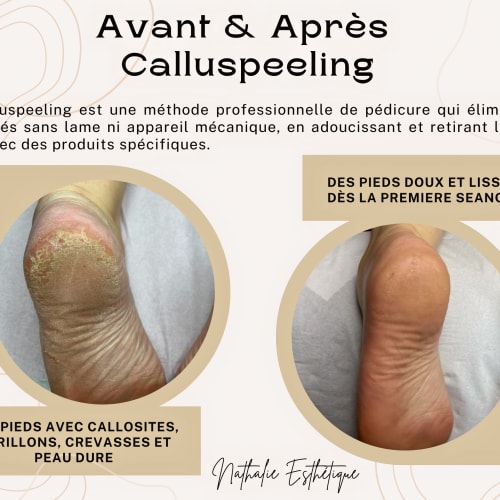 NATHALIE ESTHETIQUE - Onglerie Montpellier - NATHALIE ESTHETIQUE - Photo Galerie - OneBooking