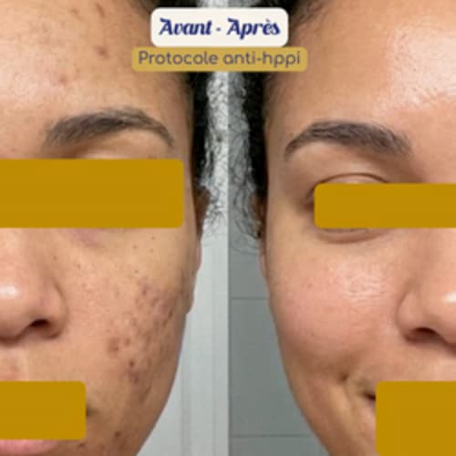 Melaskinxcare - Skin thérapeute & Esthéticienne experte peaux noires - Sourcils & cils Villejuif - Melaskinxcare - Skin thérapeute & Esthéticienne experte peaux noires - Photo Galerie - OneBooking