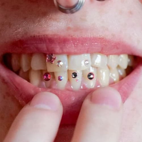 Dealeuse de gems - Grillz & Strass dentaire - Institut de beauté Rennes - Dealeuse de gems - Grillz & Strass dentaire - Photo Galerie - OneBooking