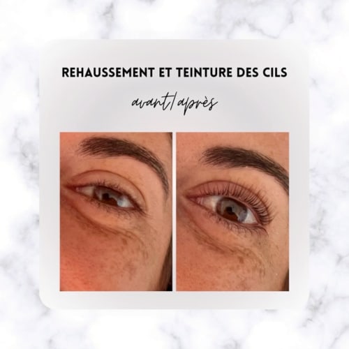 Alyna (Microneedling...) - Onglerie Toulon - Alyna (Microneedling...) - Photo Galerie - OneBooking