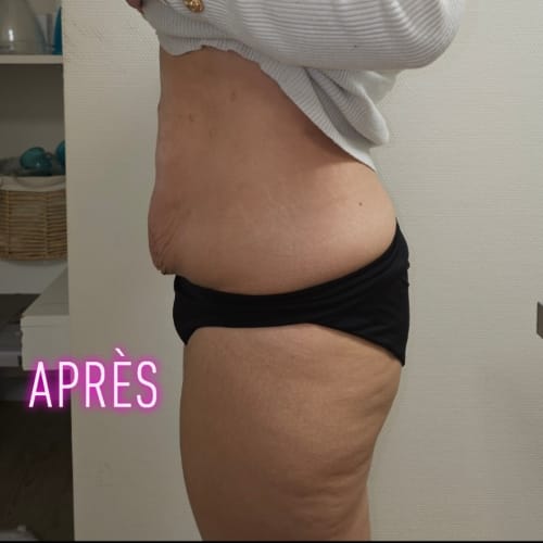 Carole Lipocavitation - Sourcils & cils Bourges - Carole Lipocavitation - Photo Galerie - OneBooking