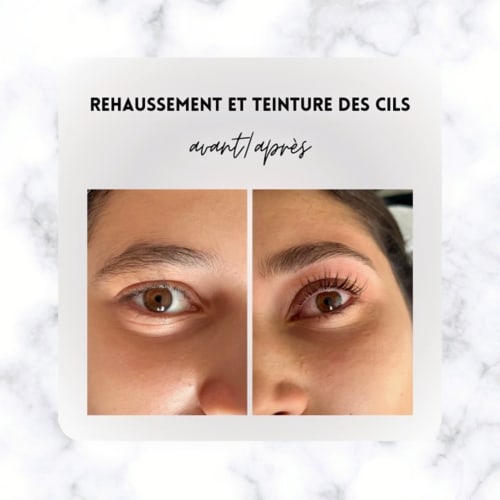 Alyna (Microneedling...) - Onglerie Toulon - Alyna (Microneedling...) - Photo Galerie - OneBooking