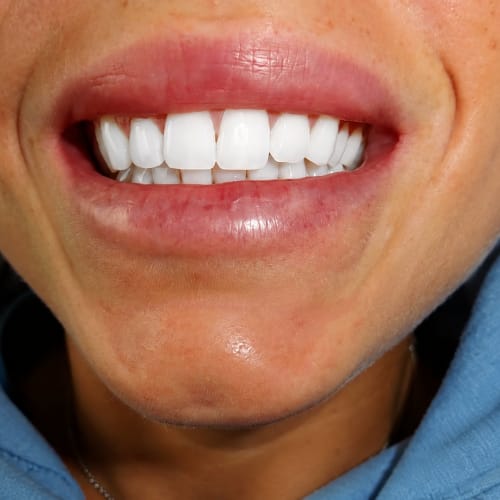 Smile Edit & Nailys Beauty - Onglerie Villefranche-sur-Saône - Smile Edit & Nailys Beauty - Photo Galerie - OneBooking