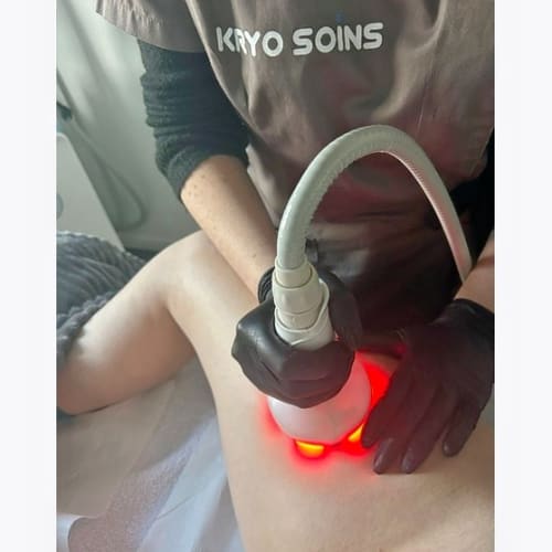 Kryo Soins - Institut de beauté Thionville - Kryo Soins - Photo Galerie - OneBooking