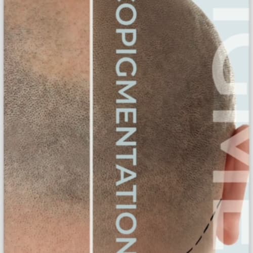 Maquillage permanent et TRICOPIGMENTATION - BEAUTIFUL PEOPLE - FORMATION PMU - Sourcils & cils Nice - Maquillage permanent et TRICOPIGMENTATION - BEAUTIFUL PEOPLE - FORMATION PMU - Photo Galerie - OneBooking