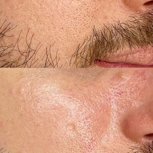 PURE Aesthetics - Institut de beauté Montpellier - PURE Aesthetics - Photo Galerie - OneBooking