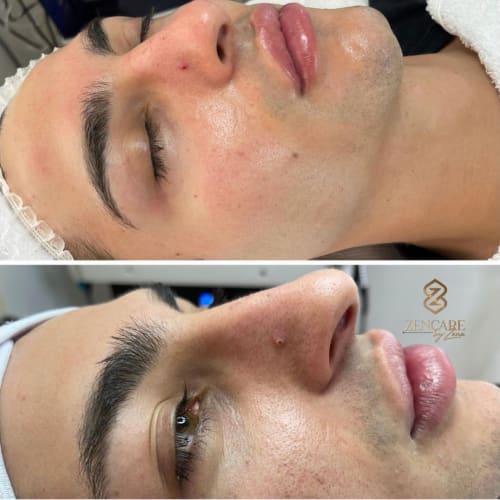 Zencare by Zena - Institut de beauté Paris - Zencare by Zena - Photo Galerie - OneBooking