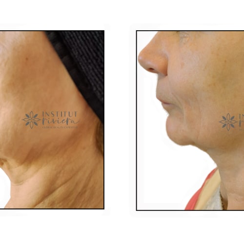 Institut Riviera | Expertise Epilation Définitive Electrolyse, Anti Age et Minceur - Institut de beauté Antibes - Institut Riviera | Expertise Epilation Définitive Electrolyse, Anti Age et Minceur - Photo Galerie - OneBooking