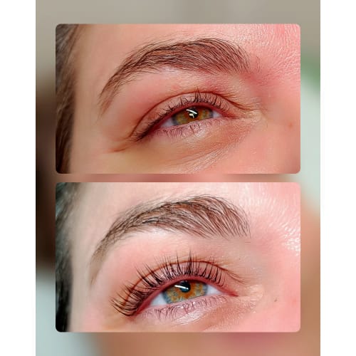 Studio Beauty & Brow - Épilation Laser - Institut de beauté Montpellier - Studio Beauty & Brow - Épilation Laser - Photo Galerie - OneBooking