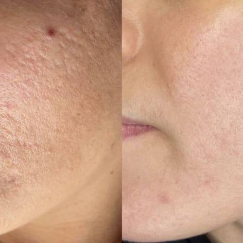 B-Otyskin Skincare - Sourcils & cils Ivry-sur-Seine - B-Otyskin Skincare - Photo Galerie - OneBooking