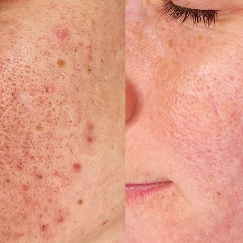 PURE Aesthetics - Institut de beauté Montpellier - PURE Aesthetics - Photo Galerie - OneBooking