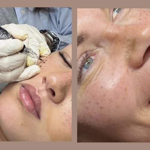 La Folie de Lolo - Sourcils & cils Nice - La Folie de Lolo - Photo Galerie - OneBooking