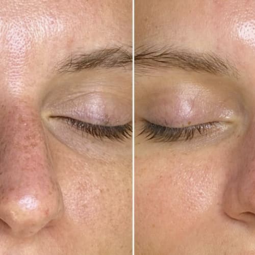 Derm AB - Coiffure Nice - Derm AB - Photo Galerie - OneBooking