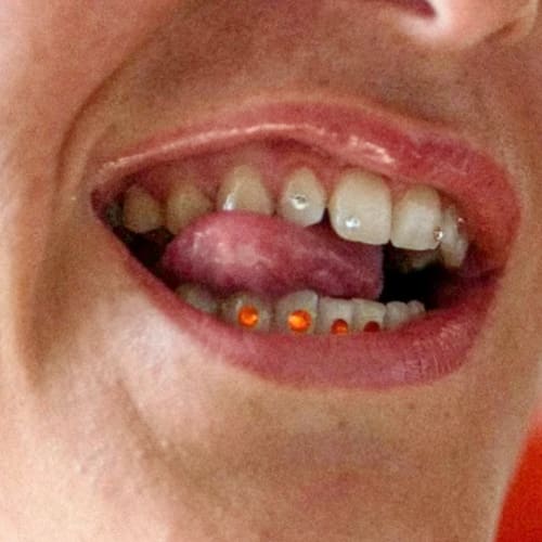 Dealeuse de gems - Grillz & Strass dentaire - Institut de beauté Rennes - Dealeuse de gems - Grillz & Strass dentaire - Photo Galerie - OneBooking