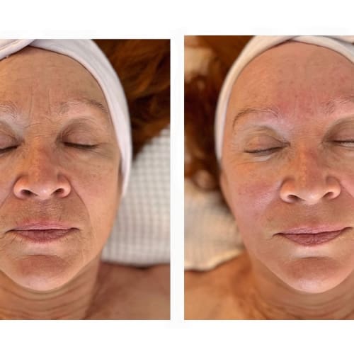 Laetitia N Facialiste - Massages anti-âge Kobido Intrabuccal Sculptant - Soin visage Nice - Laetitia N Facialiste - Massages anti-âge Kobido Intrabuccal Sculptant - Photo Galerie - OneBooking