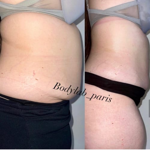 Body Lab. Paris - Sourcils & cils Pantin - Body Lab. Paris - Photo Galerie - OneBooking
