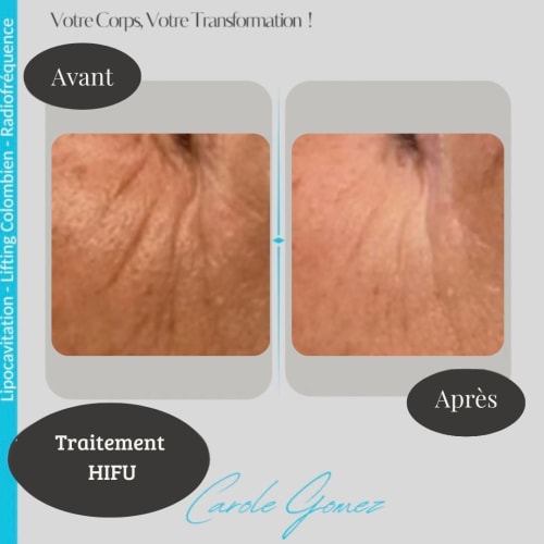 Carole Lipocavitation - Sourcils & cils Bourges - Carole Lipocavitation - Photo Galerie - OneBooking