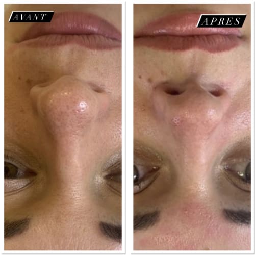 Autres regards - Institut de beauté Marseille - Autres regards - Photo Galerie - OneBooking